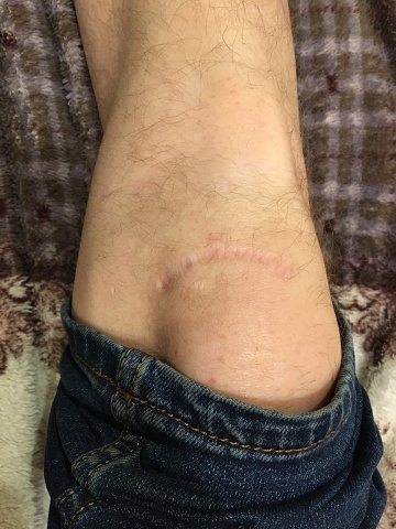 Photo 353@22-02-2020 22-46-59