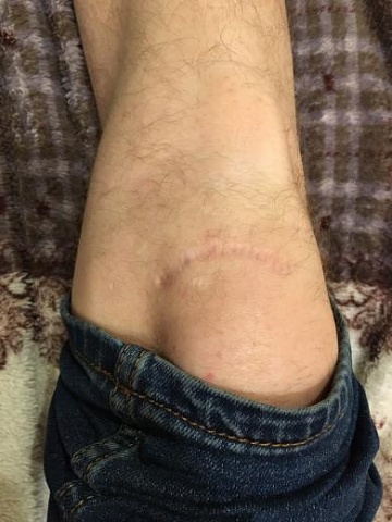 Photo 353@22-02-2020 22-46-59 Thumb